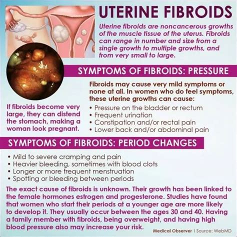 Symptoms Uterine Fibroids Symptoms, Uterine Fibroids Treatment, Fibroid ...