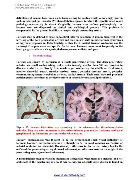 Topic of the month...The ischemic microvascular brain disease