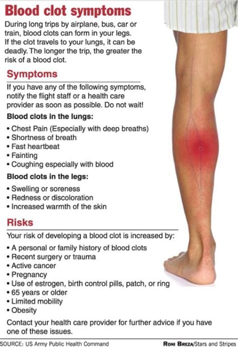 5 Methods For Minimizing Your Risk Of Blood Clots