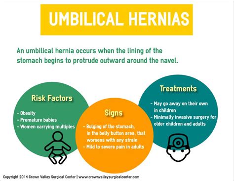 Umbilical Hernias #infographic Umbilical Hernia, Surgery Center ...