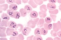 Babesia canis, blood smear shows heavy infection – Instruments Direct