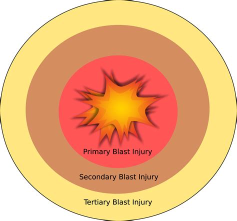 Blast Injuries – georgiaemsacademy.com