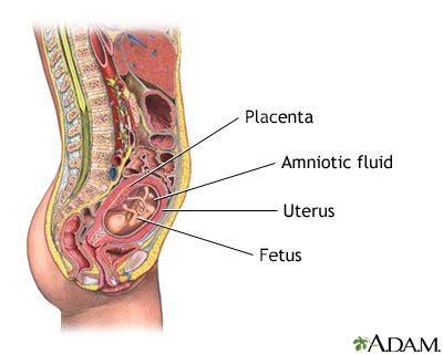 Amniocentesis Information | Mount Sinai - New York