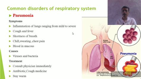 Common Disorders Of Respiratory System Youtube - Bank2home.com