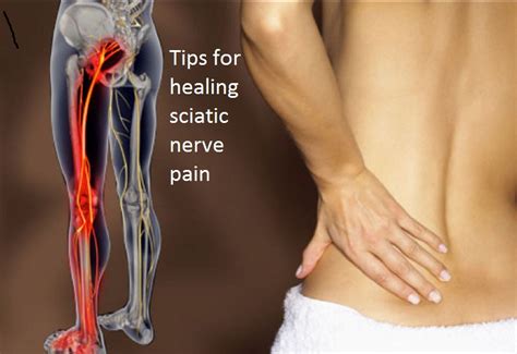 10 Tips for healing sciatic nerve pain according to health articles ...