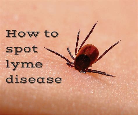 ActivMed Clinical Trials MA NH: Beware the Tick Bite: Prevention and ...