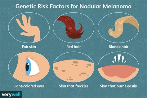 Nodular Melanoma: Causes and Risk Factors