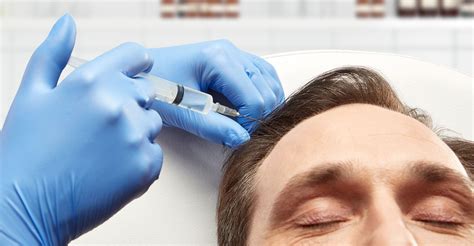 Non-Surgical Hair Restoration: Understanding the Basics of PRP Therapy ...