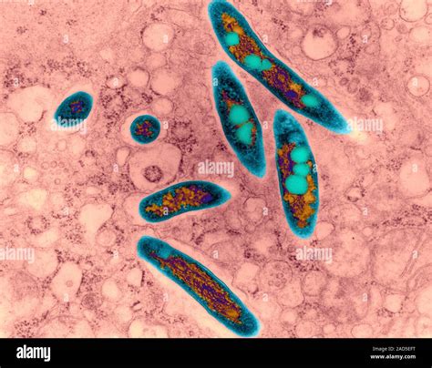 Coloured transmission electron micrograph (TEM) of Mycobacterium avium ...