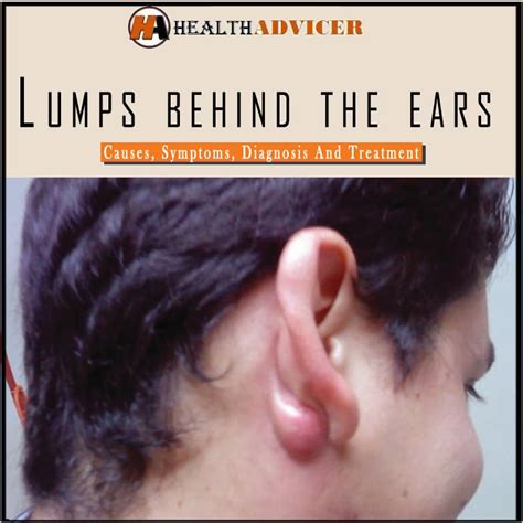 Lumps Behind The Ears: Causes, Symptoms, Diagnosis And Treatment