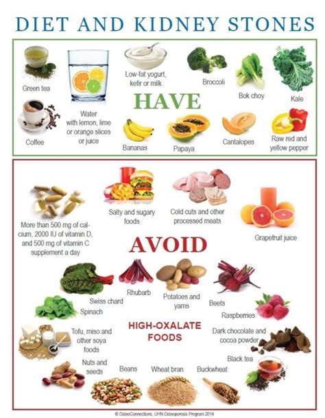 Kidney stone diet chart – Printable graphics