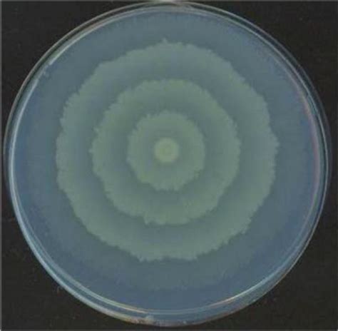 total Surgir Pilar proteus mirabilis colony morphology Pebish Espinoso lino