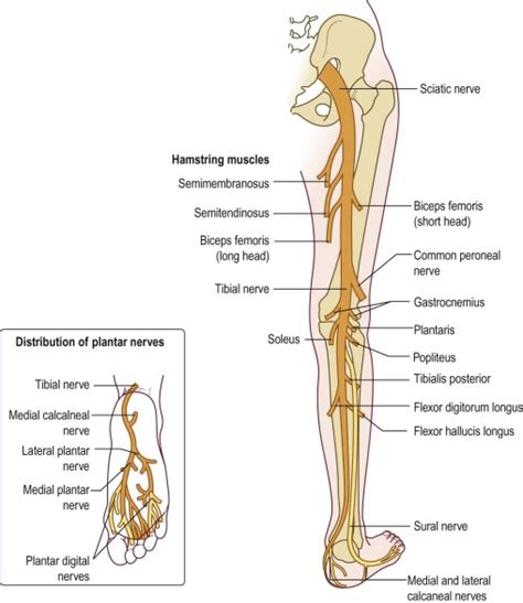 Sciatic Neuropathy | Musculoskeletal Key