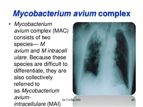 Mycobacterium Avium Complex (Disseminated & Pulmonary Disease ...