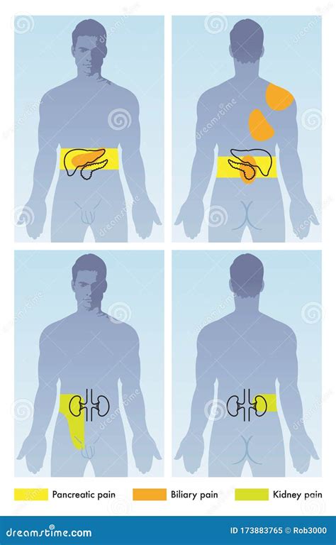 Kidney Pain Location