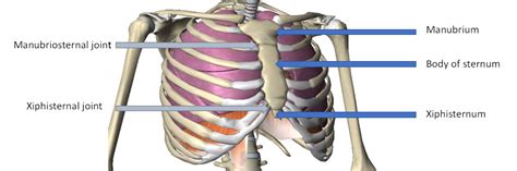 Broken Sternum X Ray