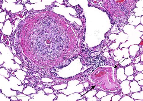 Pulmonary Artery Histology