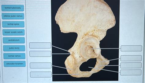 [Solved] ischial tuberosity inferior pubic ramus ischial spine lesser ...