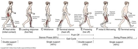 Gait in prosthetic rehabilitation - Physiopedia