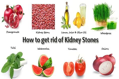 25 Easy Natural Remedies for Kidney Stones That Can Help Flush it Out ...