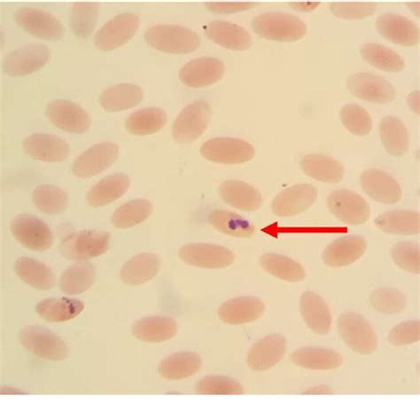 Thin blood smears stained with Giemsa stain show Babesia spp. inside ...