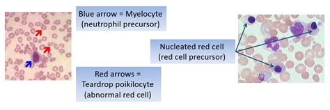 Teardrop Cell