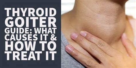 The 7 Causes of Thyroid Goiter & How to Fix Your Goiter Fast