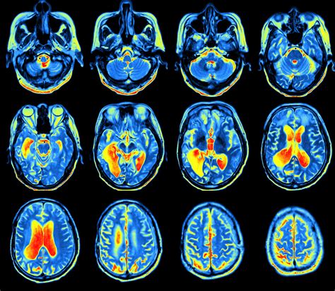 What is Nuclear Imaging?