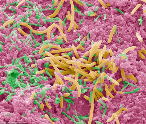 Horrifying close-up pictures reveal the bacteria living inside our mouths