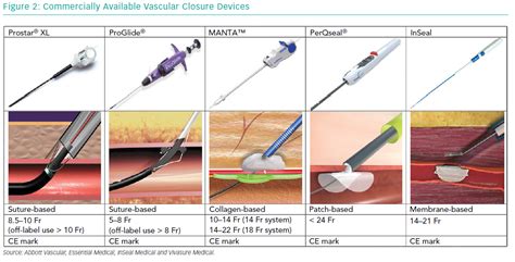 Commercially Available Vascular Closure Devices | Radcliffe Cardiology