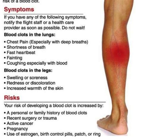 Lower Leg Blood Clot Symptoms