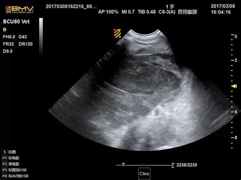 Ultrasound image sample