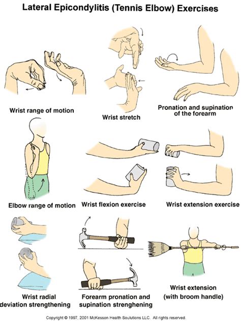 Tennis elbow | Tennis elbow, Tennis elbow exercises, Elbow exercises