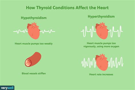 How Does Thyroid Disease Affect the Heart?