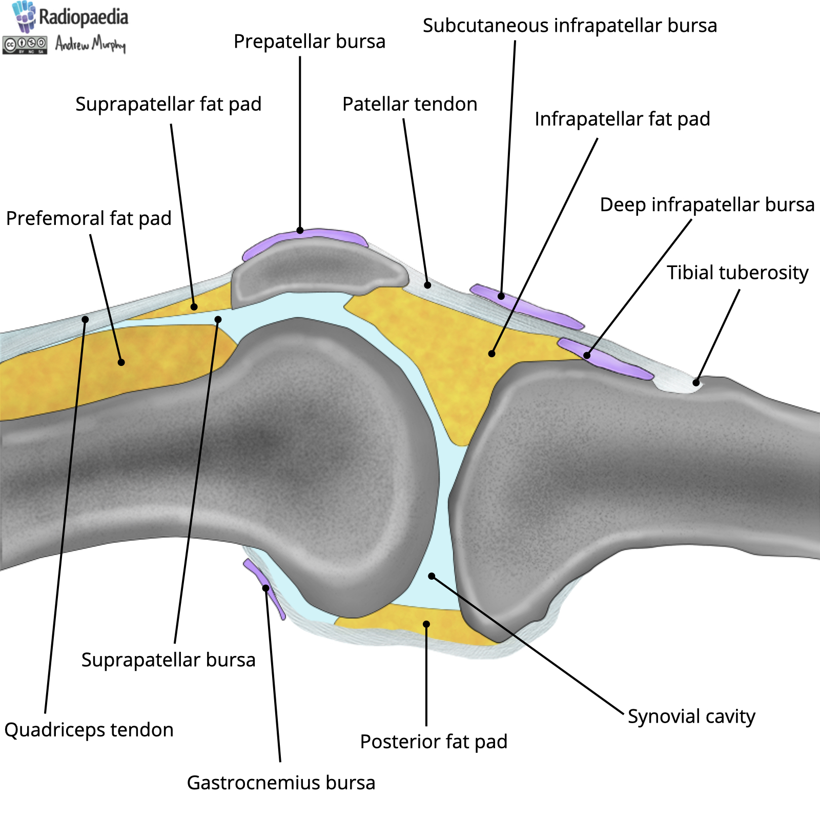 Radiopaedia - Drawing Fat pads and bursae of the knee - English labels ...