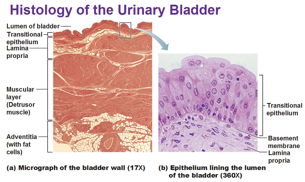 Bladder Slide Labeled