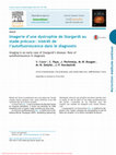 Research paper thumbnail of Imagerie d’une dystrophie de Stargardt au stade précoce : intérêt de l’autofluorescence dans le diagnostic