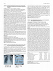 Research paper thumbnail of AB0360 Clinical and high resolution ct study of the lungs in 96 egyptian patients with rheumatoid arthritis