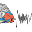 @MultimodalNeuroimagingLab