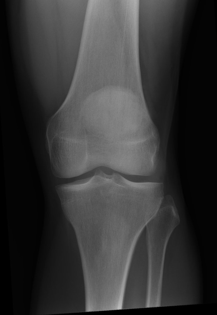 [DIAGRAM] Diagram Of Normal Knee - MYDIAGRAM.ONLINE