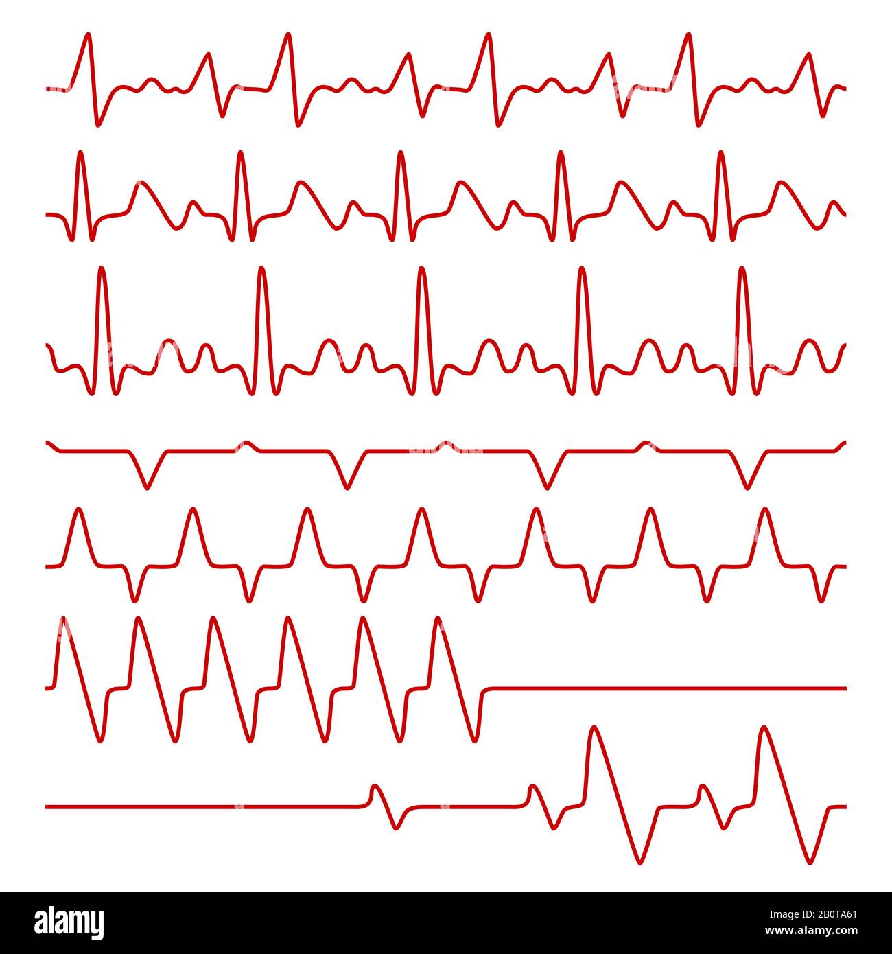 Line vector cardiograms or electrocardiogram on monitor, heartbeat medical symbols. Cardiogram pulse heart, illustration of chart pulse heartbeat Stock Vector