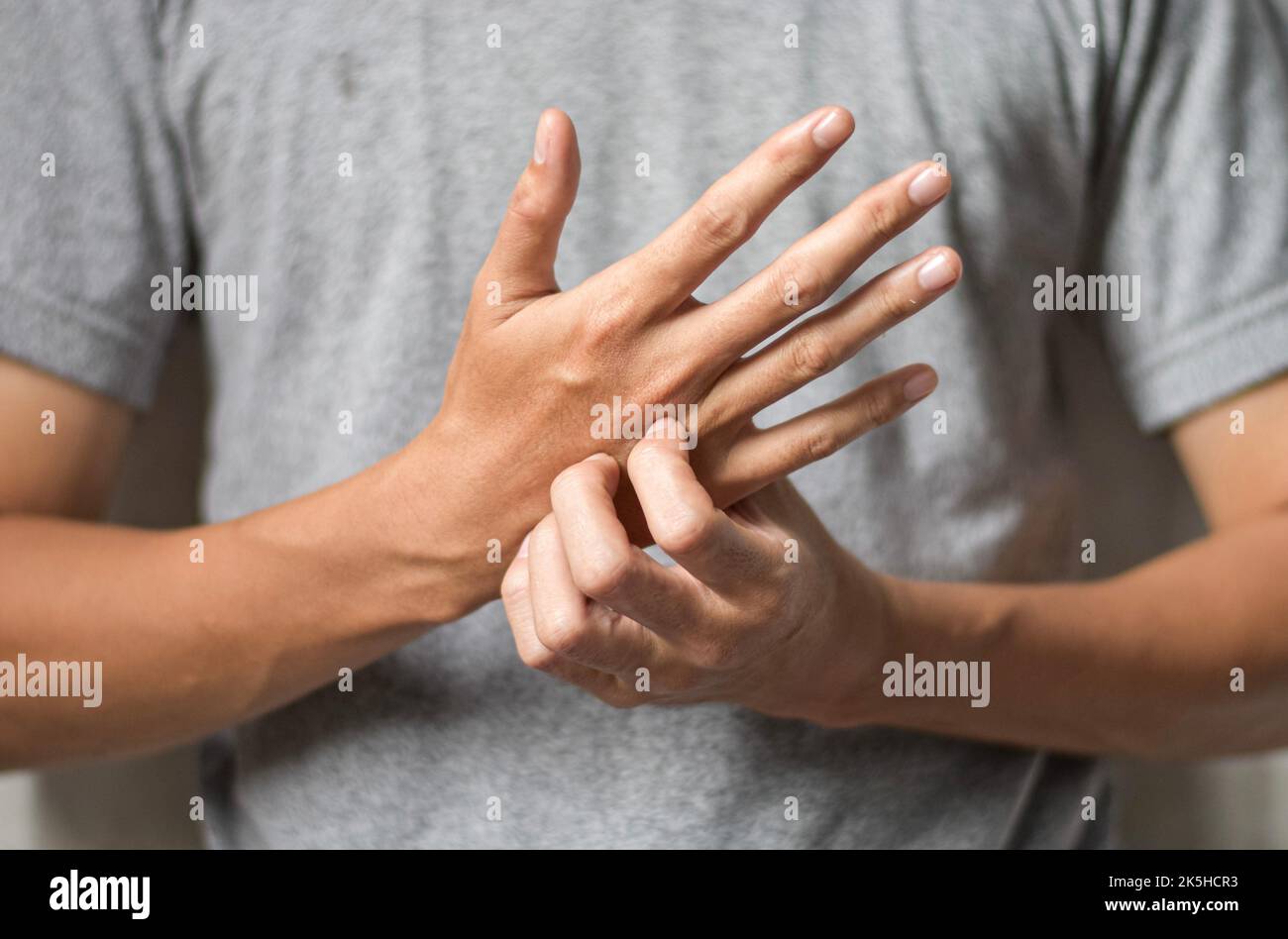 Asian young man scratching his hand. Concept of itchy skin diseases such as scabies, fungal infection, eczema, psoriasis, rash, allergy, etc. Stock Photo