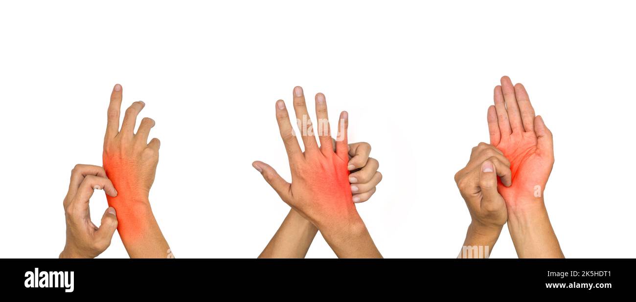 Asian young man scratching his hand. Concept of itchy skin diseases such as scabies, fungal infection, eczema, psoriasis, allergy, etc. Stock Photo