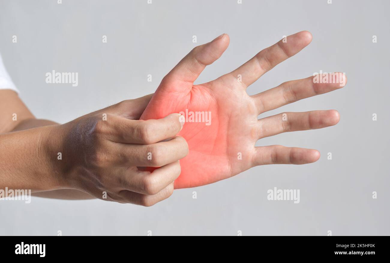 Asian young man scratching his hand. Concept of itchy skin diseases such as scabies, fungal infection, eczema, psoriasis, rash, allergy, etc. Stock Photo