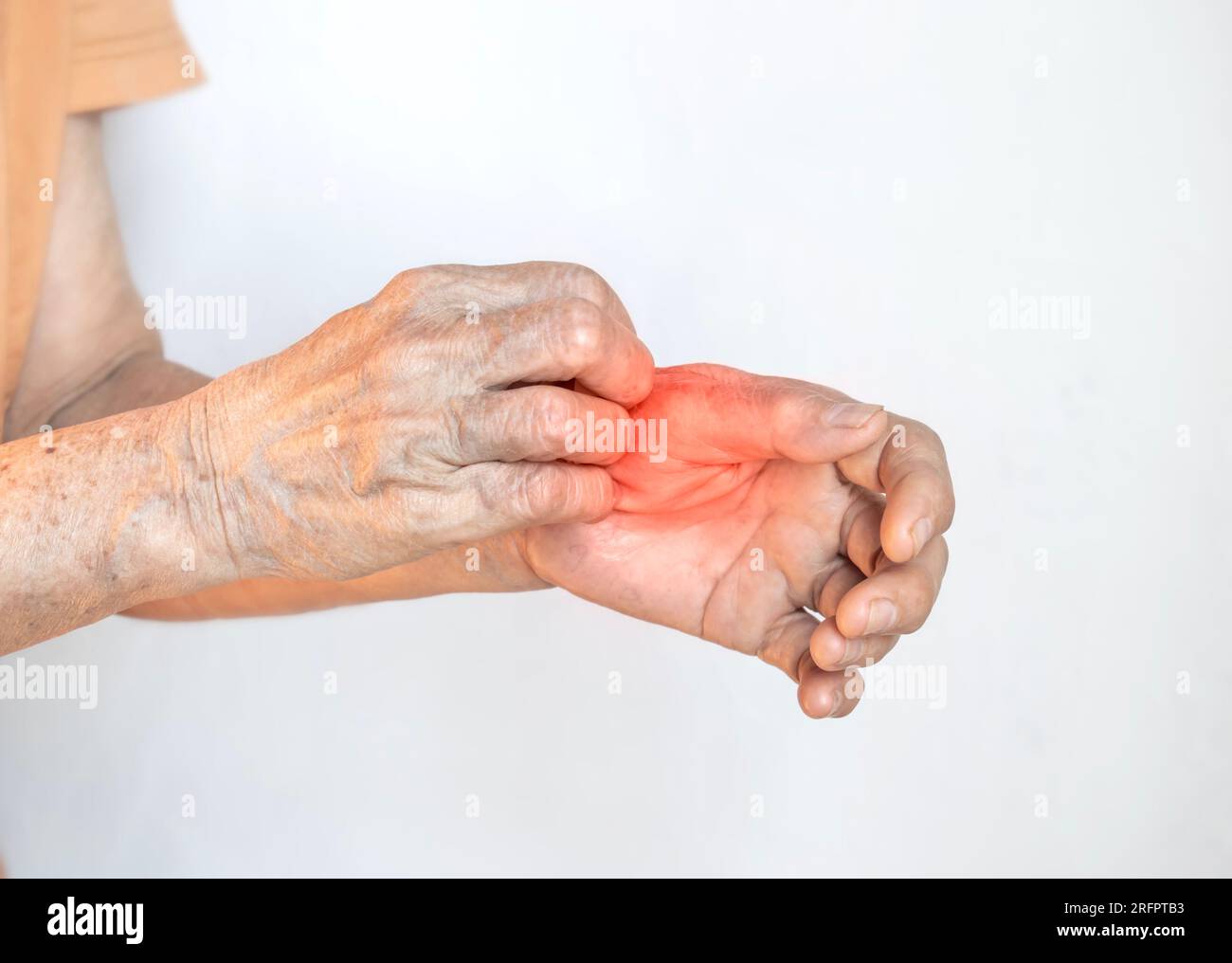 Asian elder woman scratching her hand. Concept of itchy skin diseases such as scabies, fungal infection, eczema, psoriasis, rash, allergy, etc. Stock Photo