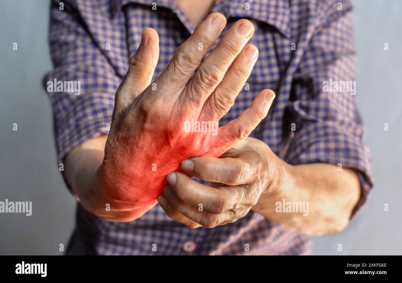 Asian elder woman scratching her hand. Concept of itchy skin diseases such as scabies, fungal infection, eczema, psoriasis, rash, allergy, etc. Stock Photo