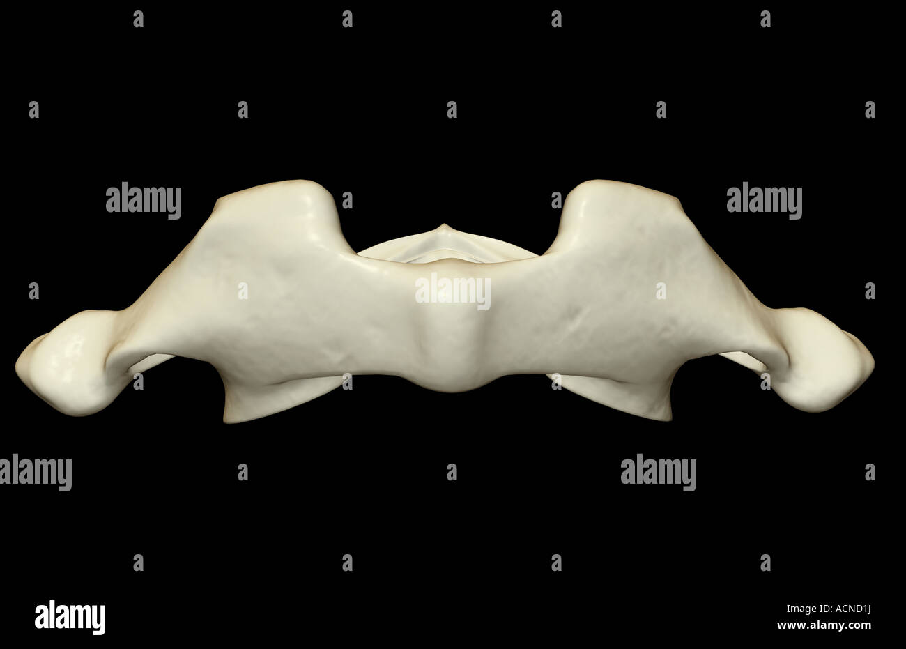 Atlas Bone Anatomy