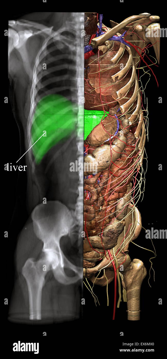 Different viewing modes such as X-ray imaging may be chosen from any direction and for any part of the image. The X-ray image may be interrogated as to which object contributes to the image. Stock Photo