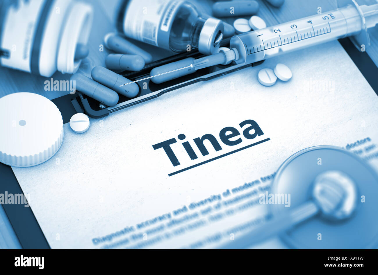 Tinea Diagnosis. Medical Concept. Stock Photo