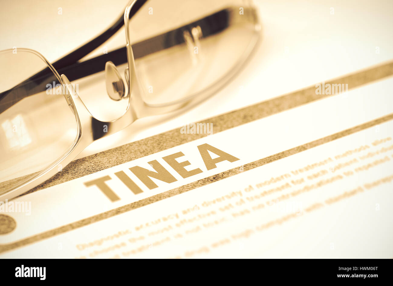 Diagnosis - Tinea. Medicine Concept. 3D Illustration. Stock Photo